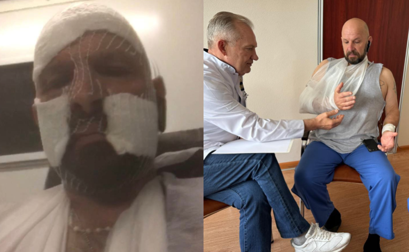 Лікарі з Дніпра врятували захисника з Тернопільщини, якому уламок потрапив в око