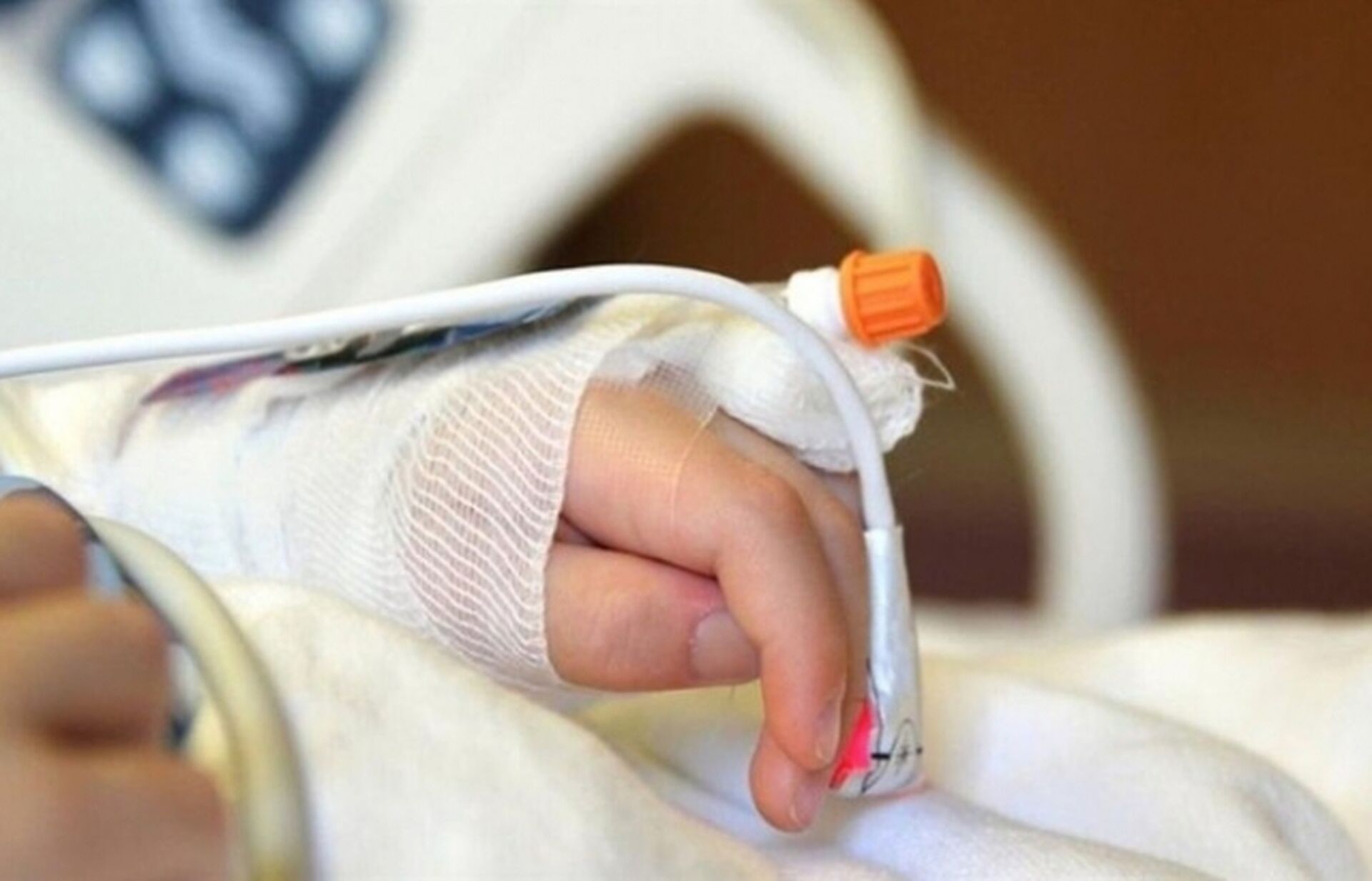 Палила суху траву: мешканка Чортківщини отримала 18% опіків тіла