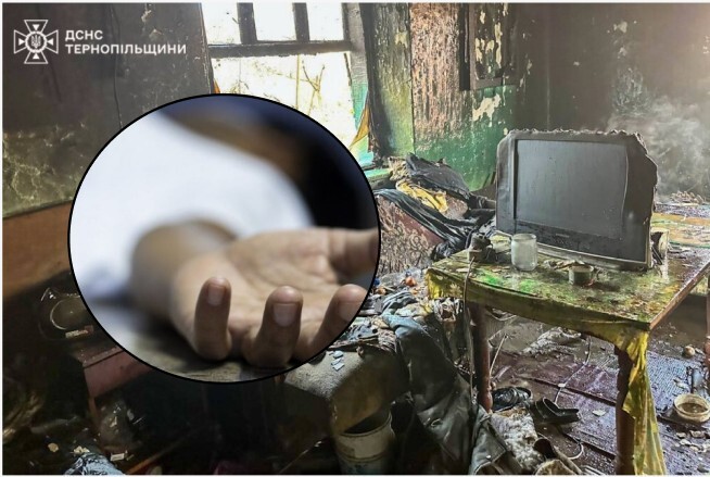 Не пережив опіків: після 11 днів боротьби помер чоловік, який постраждав у пожежі на Тернопільщині